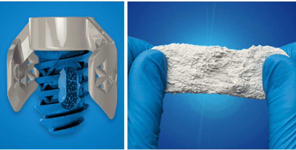 SurGenTec Wins Two Spine Technology Awards for 2024 | A&nbsp;Summary